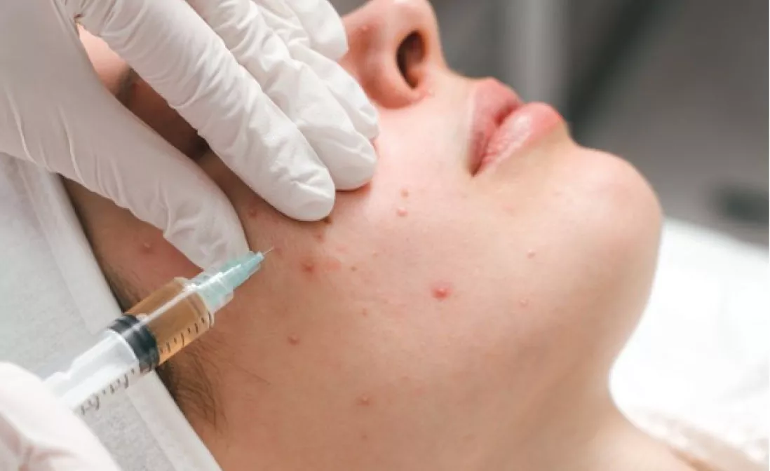 Genix Aesthetica ||  Treatment Removal Tattoo in Bhubaneswar in Bhubaneswar || Genix Aesthetica About Image